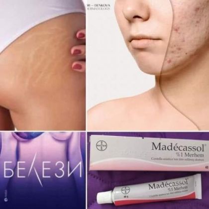 МАДЕКАСОЛ МЕХЛЕМ